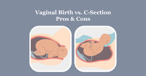 VAGINAL BIRTH VERSUS C-SECTION PROS AND CONS